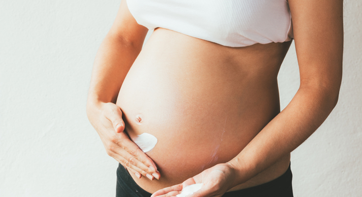 Pregnancy stretch marks: Causes, prevention, and removal