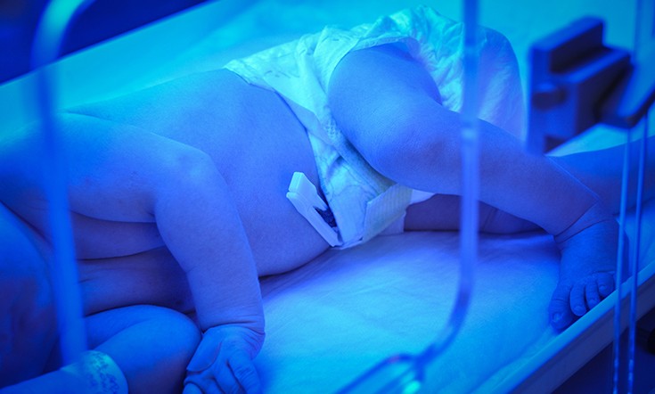 Jaundice In Newborn Babies