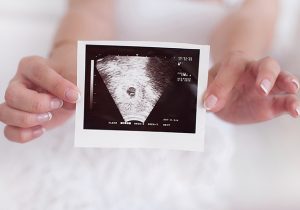 What To Expect at Your 12 Week Scan