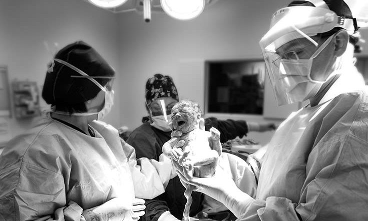 Attempts to reduce c-sections could cause other problems, experts warn