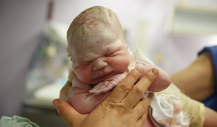 Newborn skin: What’s normal?