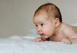 Torticollis in Infants